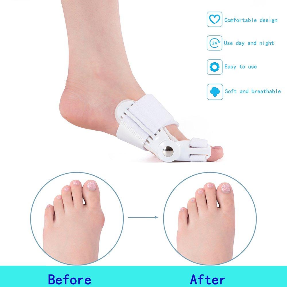 Zehenspreizer für Männer & Frauen - Orthopädische Zehenkorrektur , Hallux Valgus Brace